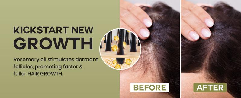 Lebanta Batana Oil For Hair Growth - 100% Pure, Raw & Natural Blend With Organic Castor, Pumpkin Seed, Coconut and Rosemary Oil - Thicker, Stronger Hair For Men & Women Scalp, Haircare Serum Lebanta Batana Oil For Hair Growth - 100% Pure, Raw & Natural Blend With Organic Castor, Pumpkin Seed, Coconut and Rosemary Oil - Thicker, Stronger Hair For Men & Women Scalp, Haircare Serum