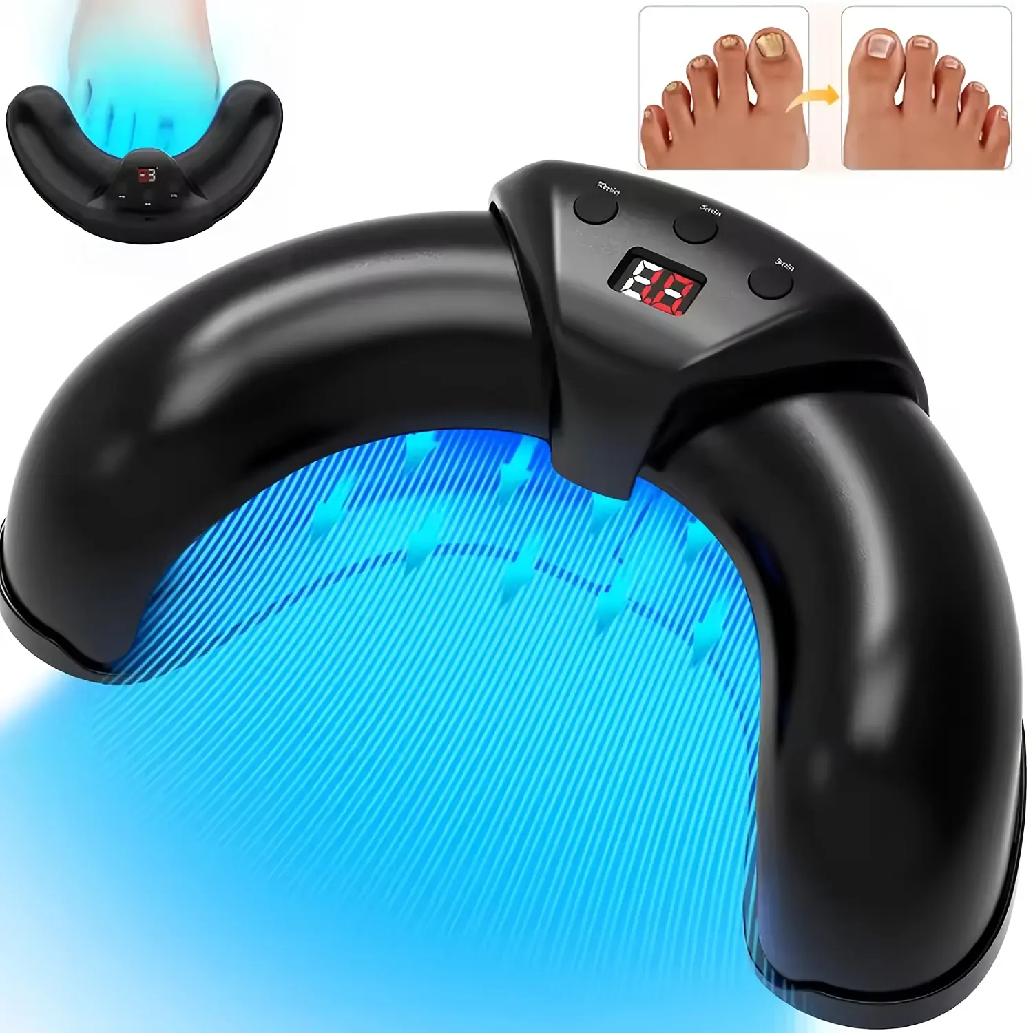 FDA-Cleared Laser Fungus Remover Device for Damaged, Discolored, Thick Nails - Fungal Relief, Repair, USB-Powered Rechargeable Nail Care Tool, Treatment, Fungus Nail Treatment