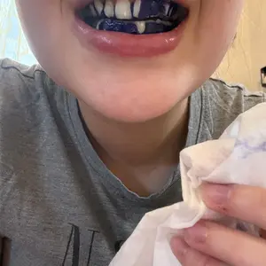 DRDENT Purple Teeth Whitening Strips - 7/21 Whitening Sessions - Safe for Enamel - Non Sensitive Teeth Whitening - Peroxide-Free