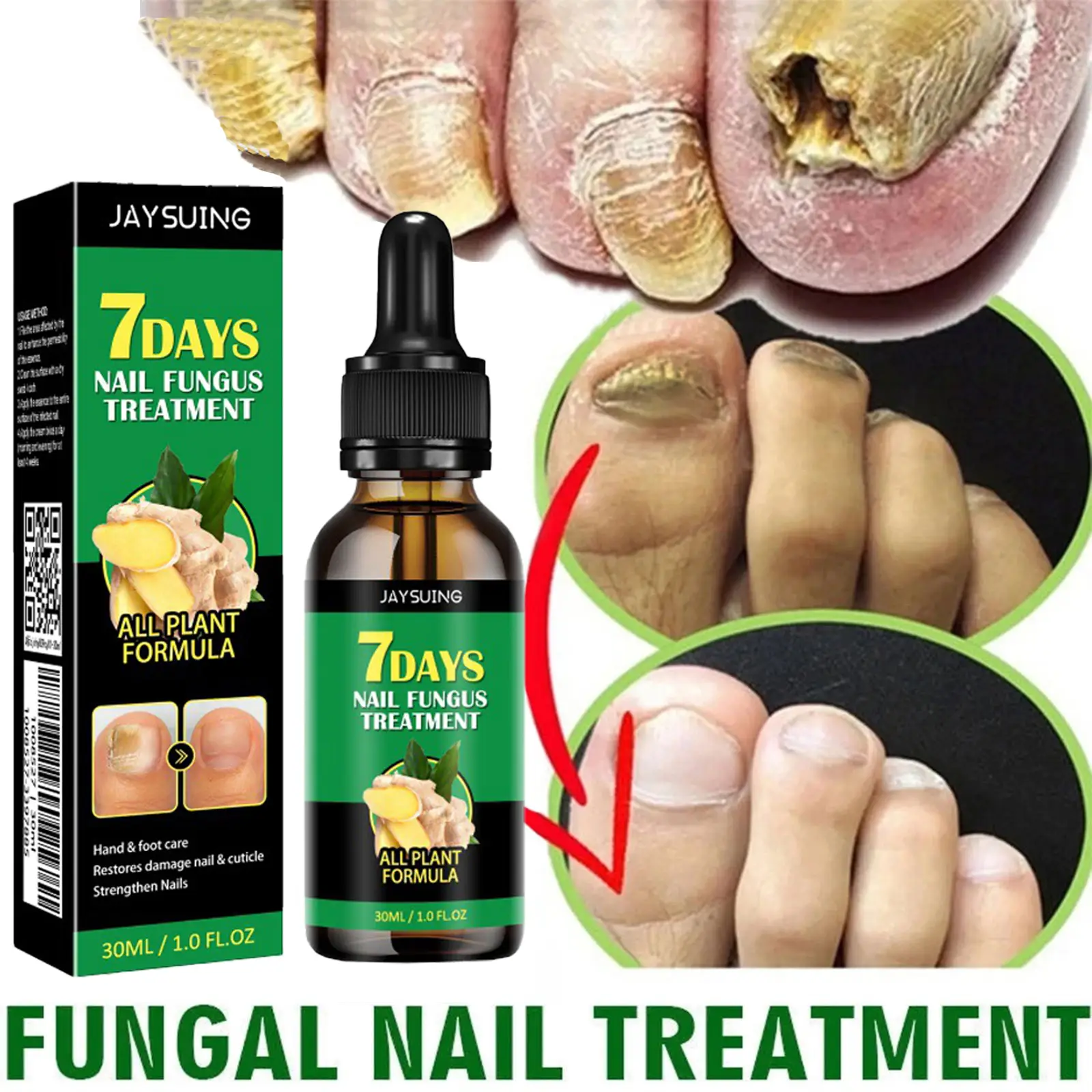 Nail Fungus Treatment – Triple-Action Formula Daily Repair for Brittle, Thick & Discolored Nails – Ginger & Undecylenic Acid, Fast-Acting, Vegan & Cru
