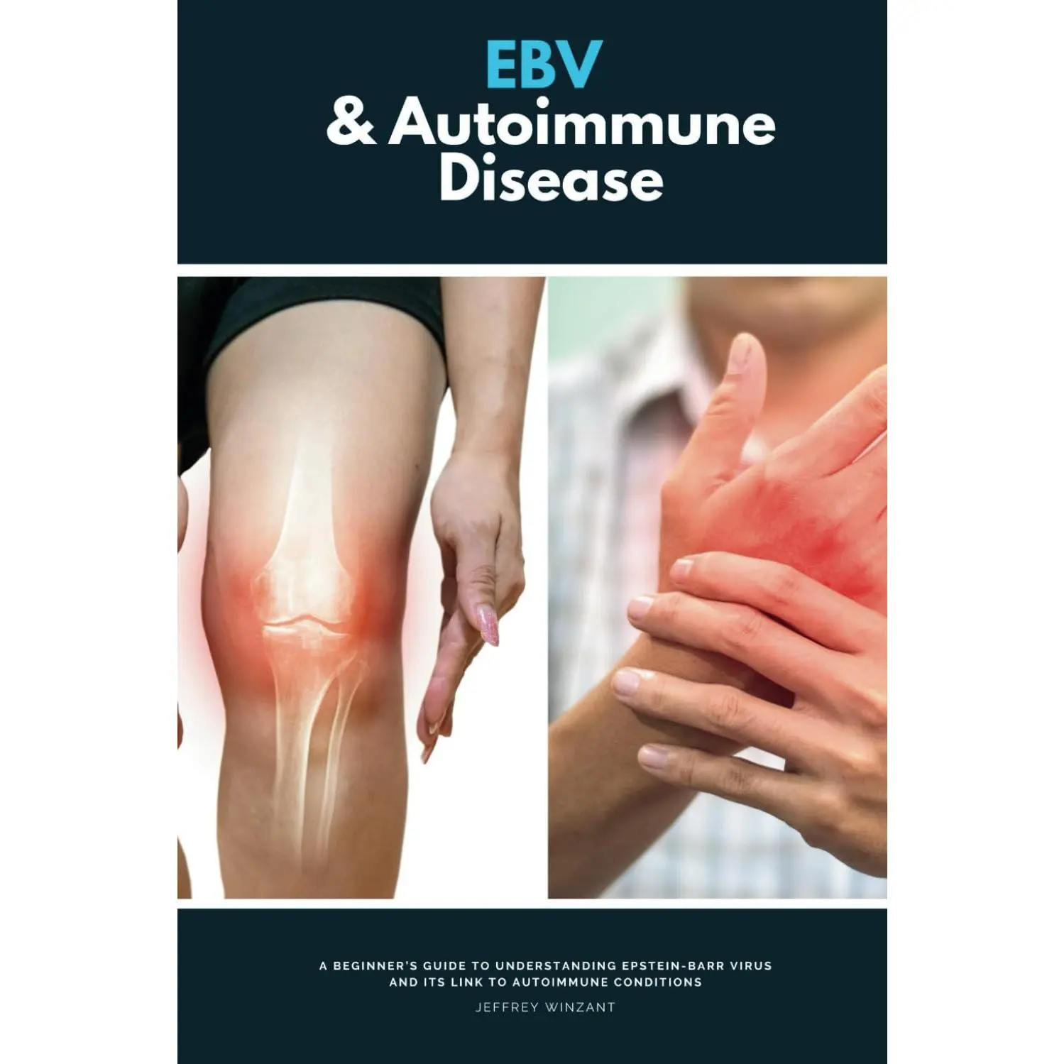 EBV & Autoimmune Disease: A Beginner’s Guide to Understanding Epstein-Barr Virus and Its Link to Autoimmune Conditions