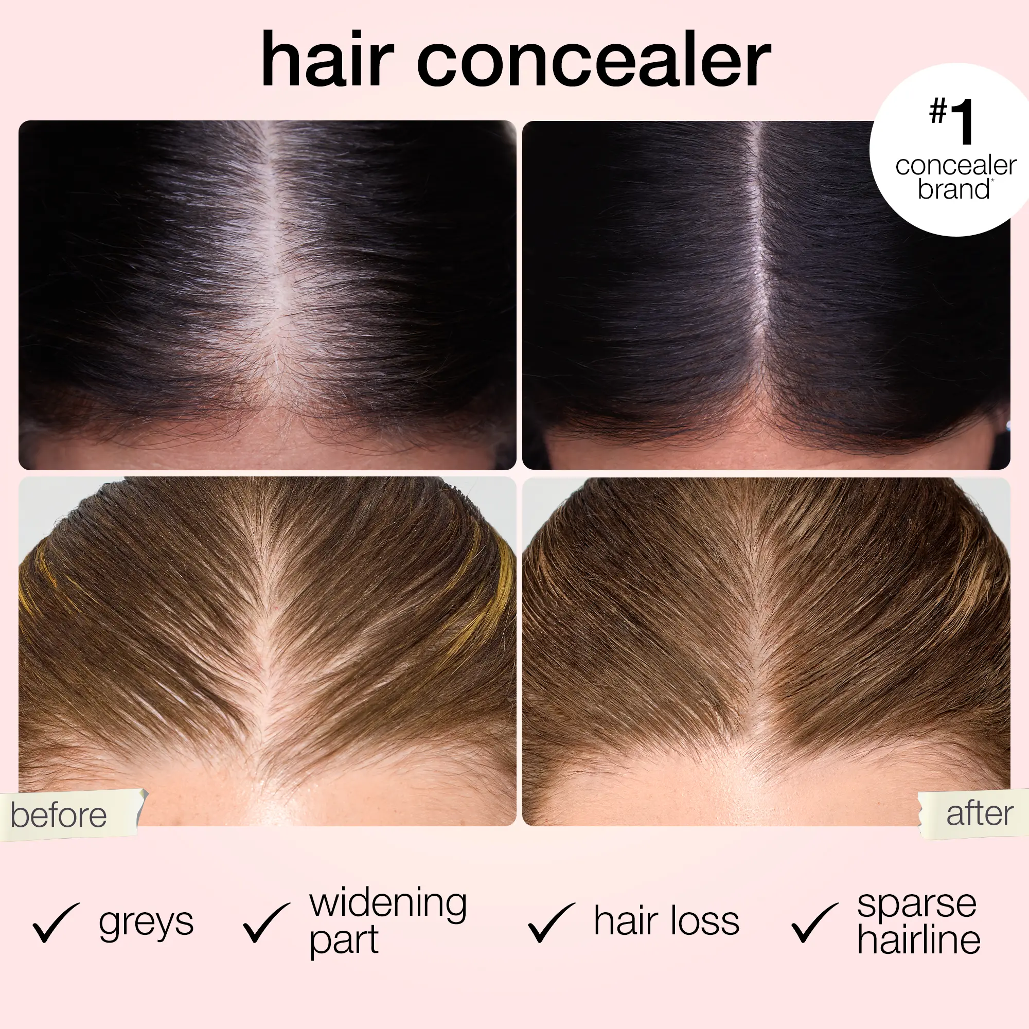 Before and after: widening part, greys and sparse hairline concealed with dab & go hair concealer