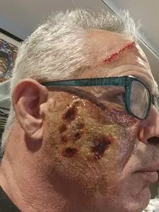 Zombie/diseased Pros aide Transfer, Perfect for Special Effects Makeup artists,Cosplay, Halloween & Character Creations!