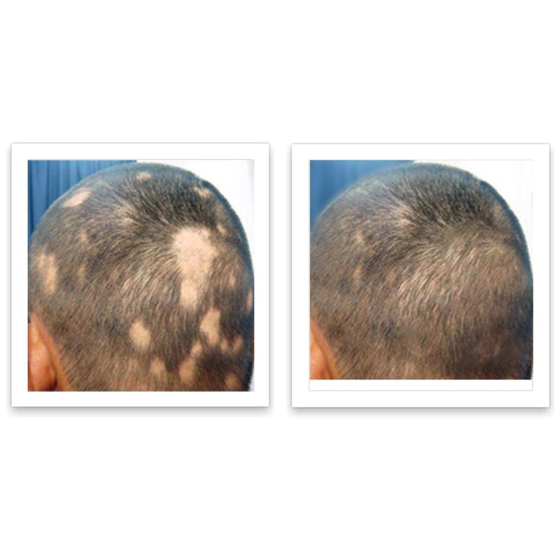 Caboki 10X Hair Powder - LIMIT ONE PER HOUSEHOLD. Full Coverage for Hairline & Thin Areas, Talc-Free Formula, Natural Ingredients, Waterproof, TRIAL SIZE