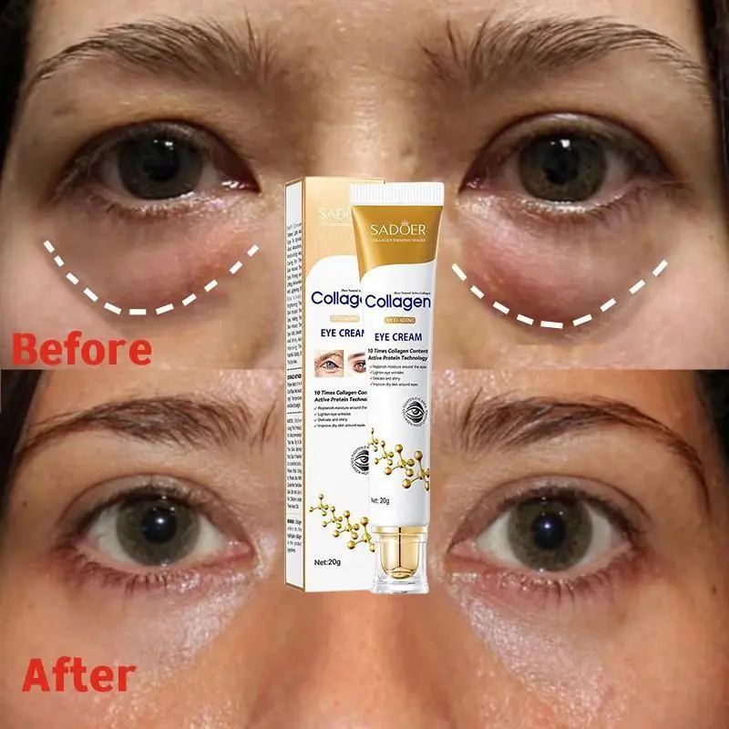 Anti-Aging Collagen Eye Cream, Firming Repair Moisturizer to Reduce Wrinkles, Dark Circles, and Puffiness, Dark Circle Eraser, Drop