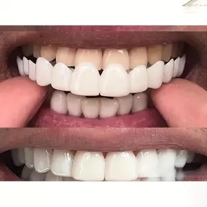 New Generation Instant Smile False Teeth, Silicone Dental Aligner, Whitening Tooth Veneers, Upper & Lower Teeth, Easy to Use
