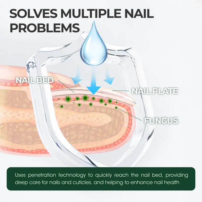 Kreain Nature 7 Days Tea Tree & Ginger Nail Treatment for