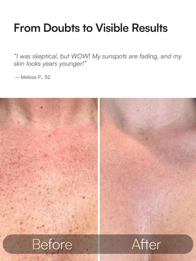 【LIVE ONLY】INIA GLOW Neck & Chest Red Light Mask – 850nm NIR | Fade Wrinkles & Spots | Lift & Firm in 4 Weeks - Red Light Skincare Device with 2600mAh Rechargeable Controller, Clinic-Grade, Full Coverage