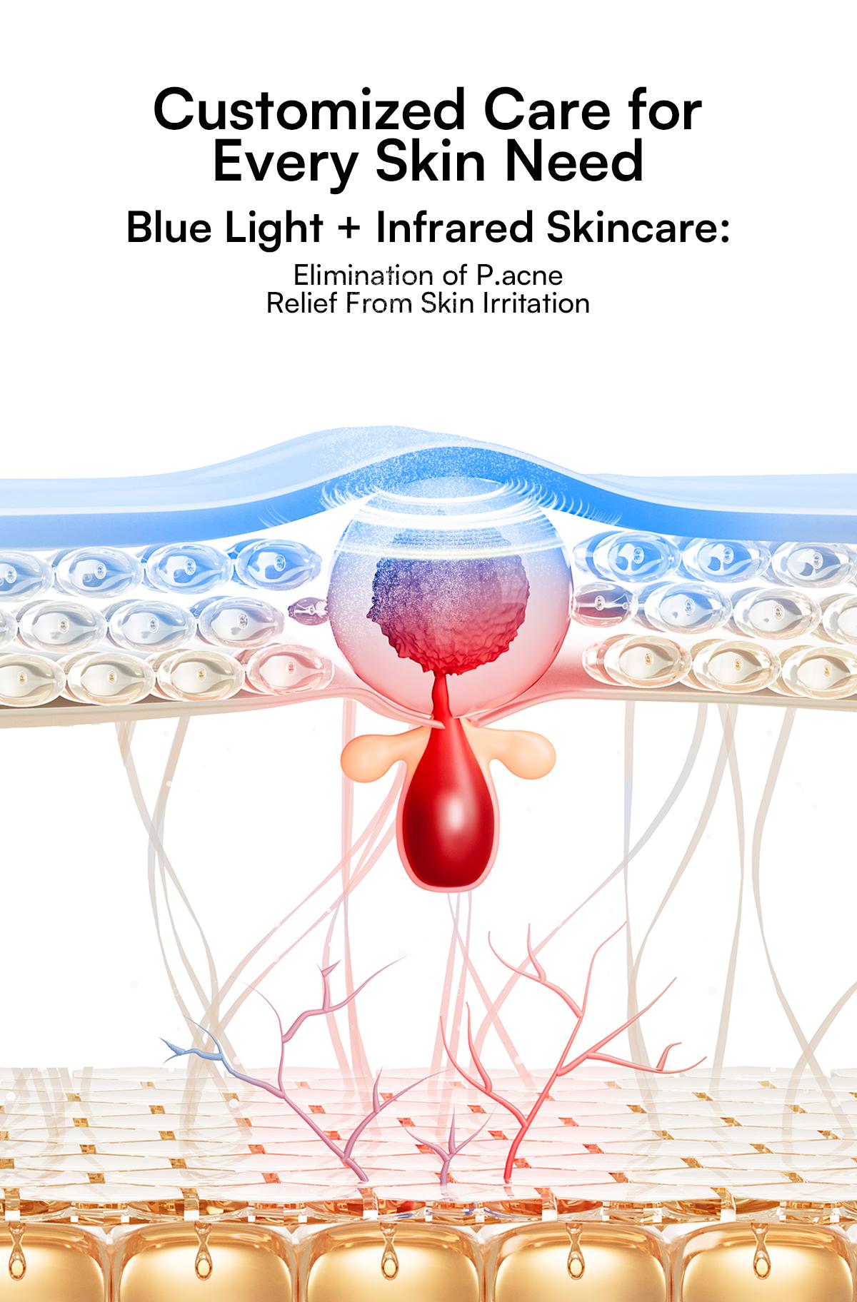 INIA GLOW Wireless LED Mask, Perfect Gift Season Pick,  Live Stream Only BUY 1 GET 10 with FLARE and 8pcs Collagen Real Deep Mask