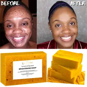 1Pc Lemon Turmeric & Kojic Acid Brightening Soap, Dark Spot Remover, Kojic Acid Soap Lemon Turmeric Kojic Acid Soap Original by Luxe Piel Lemon Kojic Acid Soap Bar Turmeric Soap Bar Kojic Acid Soap Dark Spot Remover for Face