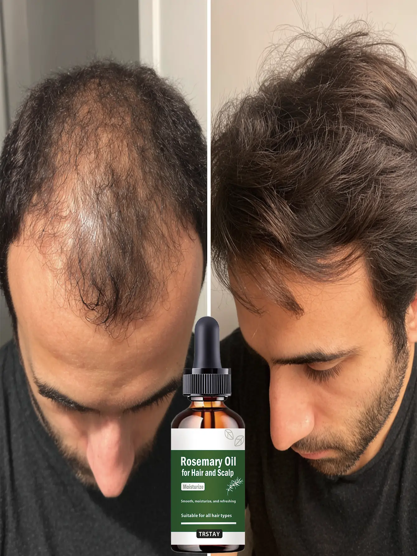 50ml Men's Hair Essence - Rosemary Extract & Hyaluronic Acid Infused, Rapid Hydration, Smooth Soft Texture, Fresh Scent, Daily Growth Treatment