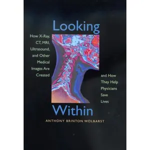 USED-Looking Within: How X-Ray, Ct, Mri, Ultrasound, and Other Medical Images Are Created, and How They Help Physicians Save Lives by Wolbarst, Anthony Brinton (Paperback)
