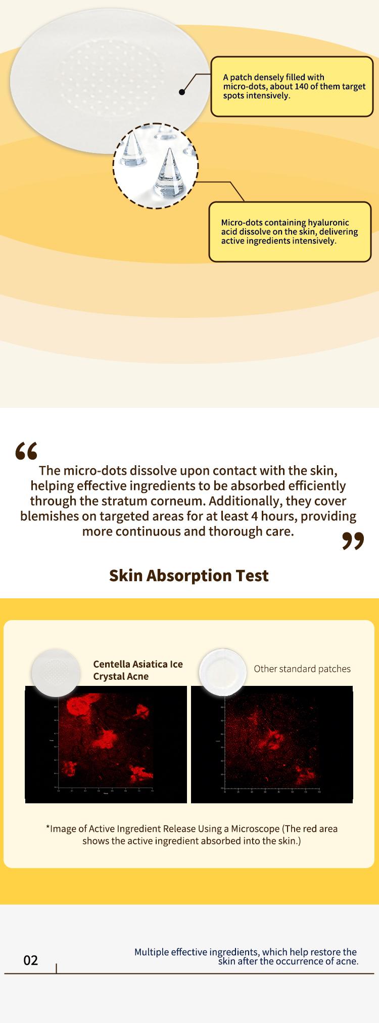 Soluble Microcrystalline Pimple Patch with Hyaluronic Acid | Deep Penetration, Skin Repair & Blemish Care