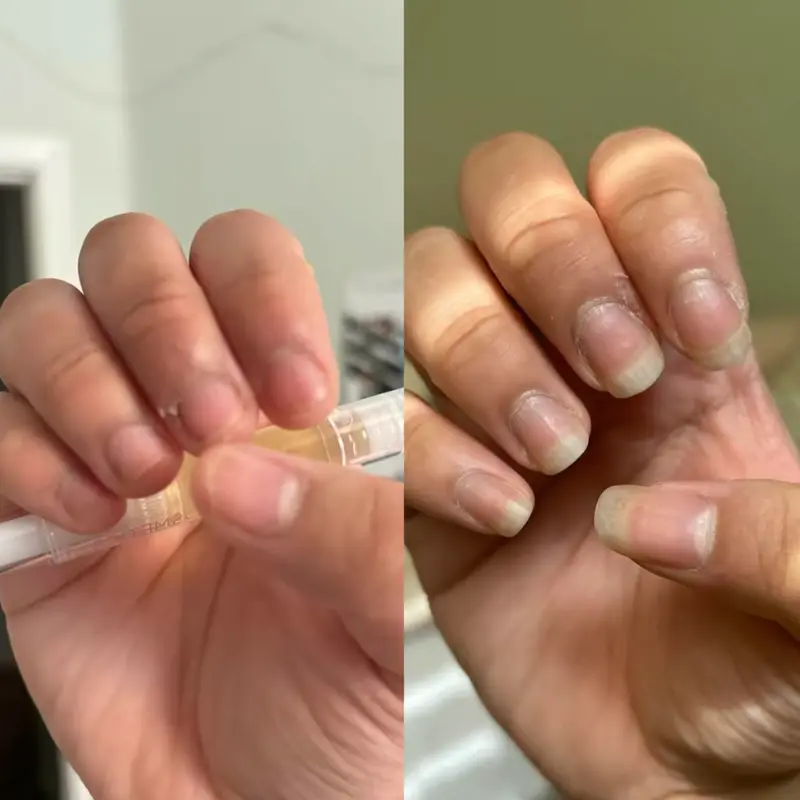 Radiant Cosmetics Nail Growth Oil - 100% Organic, Moisturizing, Growth, Strengthening, and Brightening Formula with Vitamins and Fatty Acids for Overall Nail Health 7