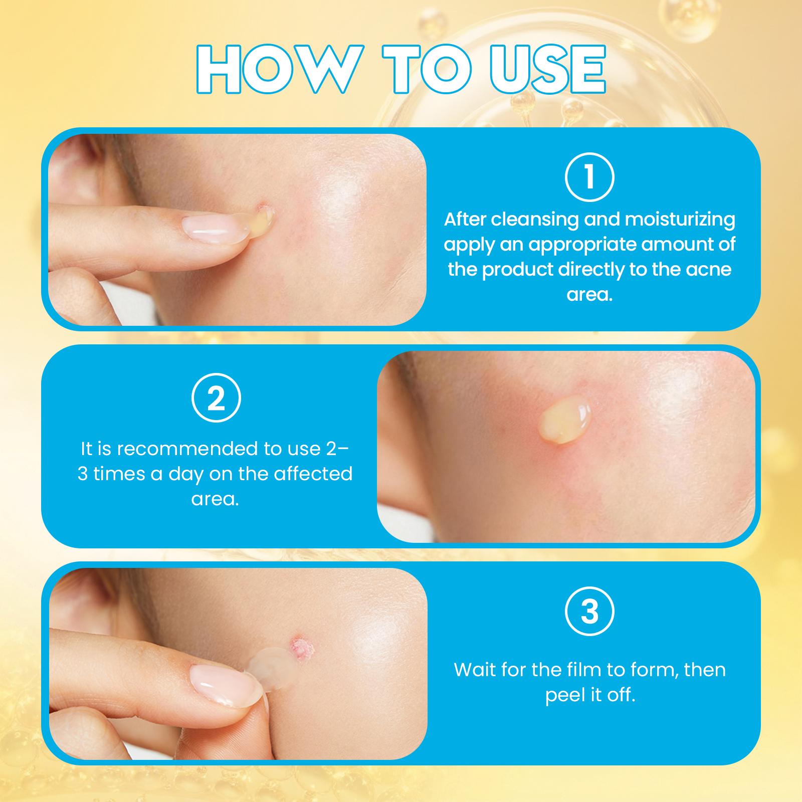 Invisible Liquid Pimple Patch | Fast-Acting Acne Spot Treatment | Calming Sulfur & Niacinamide Gel