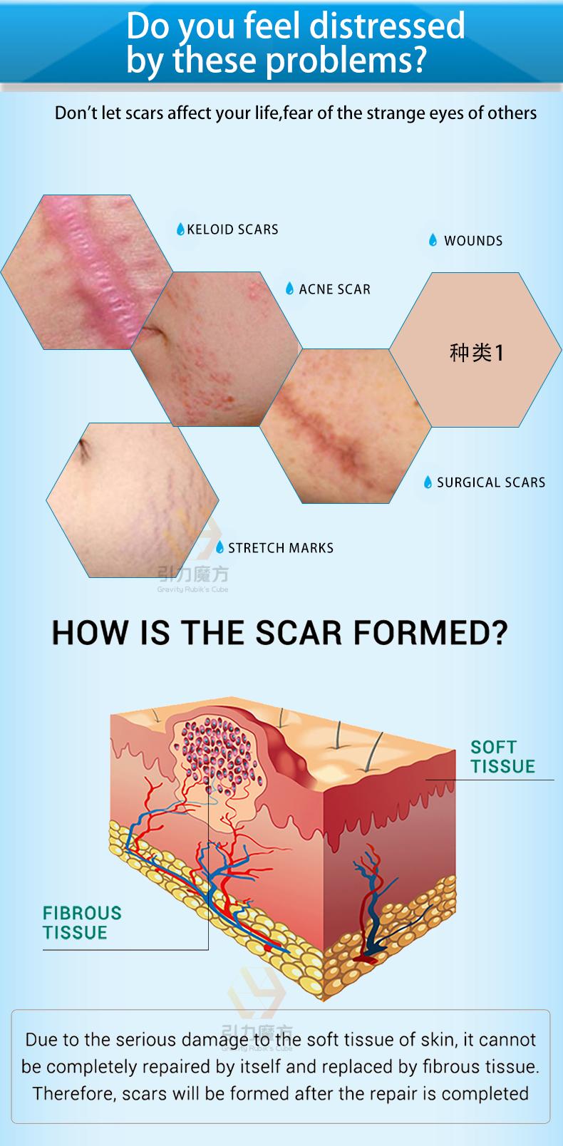 Scar Cream,Professional Scar Removal Gel,Suitable for scar removal treatment of post-operative scars,Caesarean section scars,Keloids,Burns,Acne