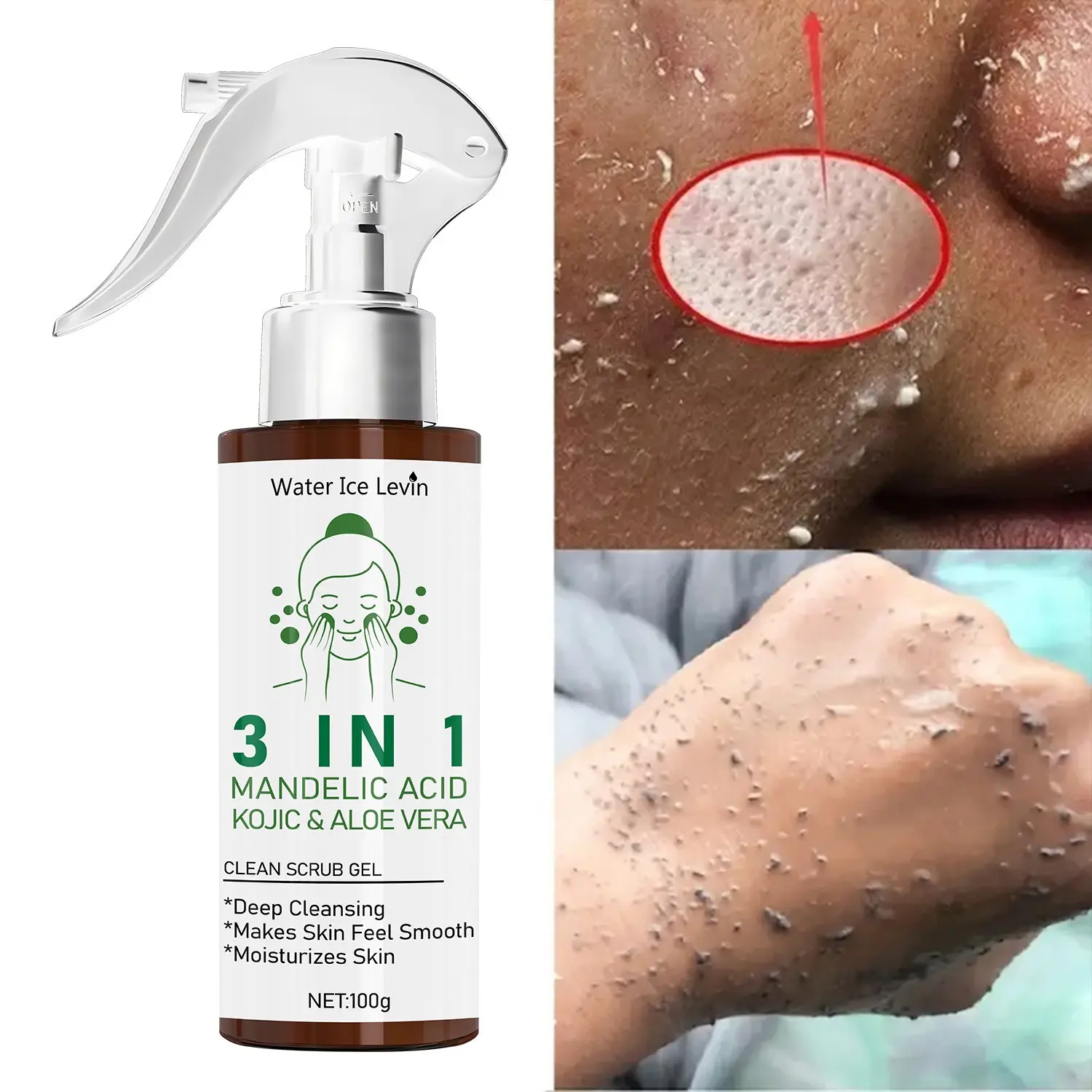 3-In-1 Salicylic Acid Aha Aloe Exfoliating Spray, Deep Cleansing Facial & Body Dead Skin Remover, Moisturizing Smooth Pore Cleaner, 100g