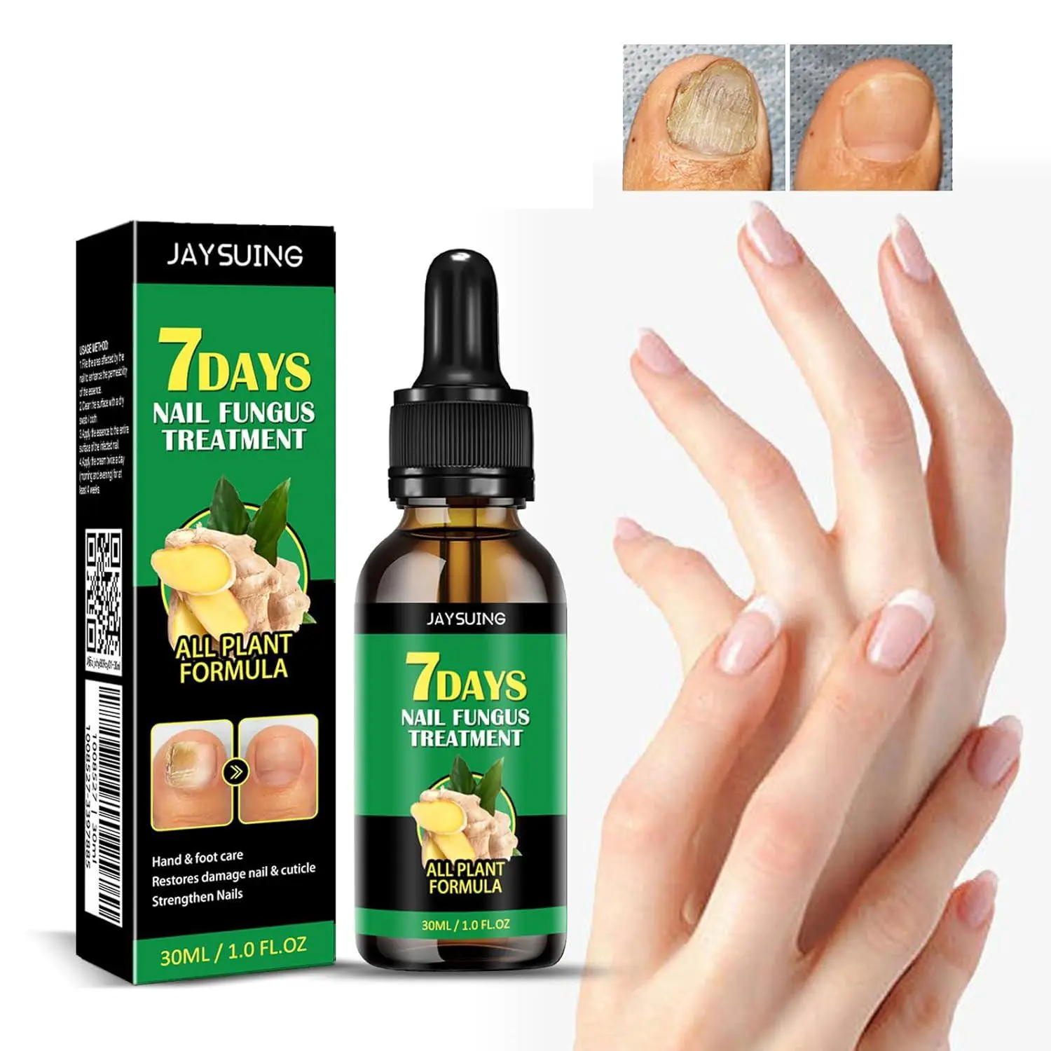 Buy One Get One Free Ginger Nail Treatment, Ginger Nail Treatment Nail Support Nail Care, Ginger Cuticle Care Oil for Nails Strengthener Oil, Daily