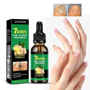 Ginger Nail Treatment, Ginger Nail Treatment Nail Support Nail Care, Ginger Cuticle Care Oil for Nails Strengthener Oil, Daily