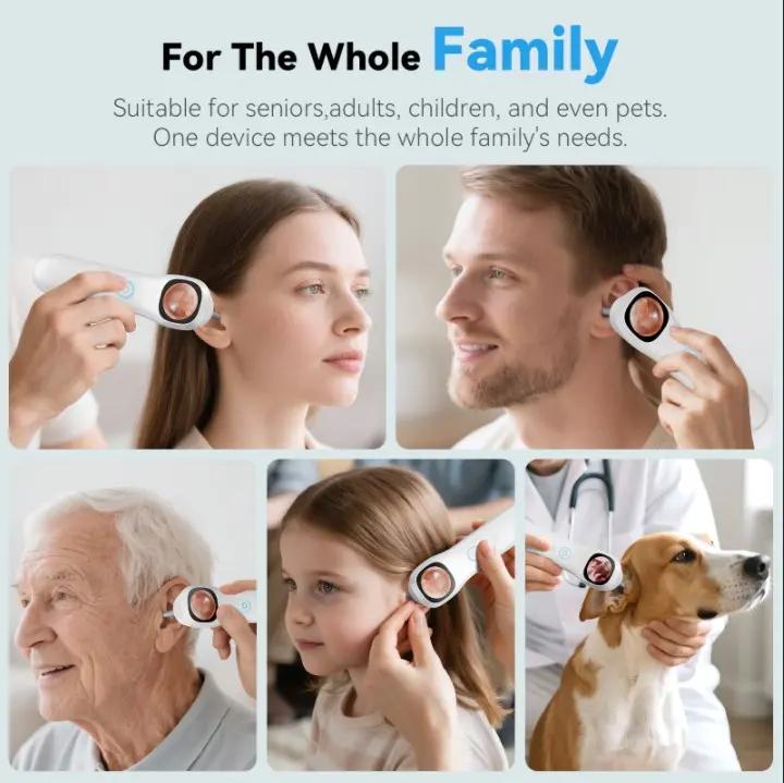 1080P HD Visual Ear Cleaner, 5-in-1 Smart Ear Detector with Built-in IPS Screen, Plug-and-Play Video Otoscope for Ear, Nose, Oral & Skin Observation