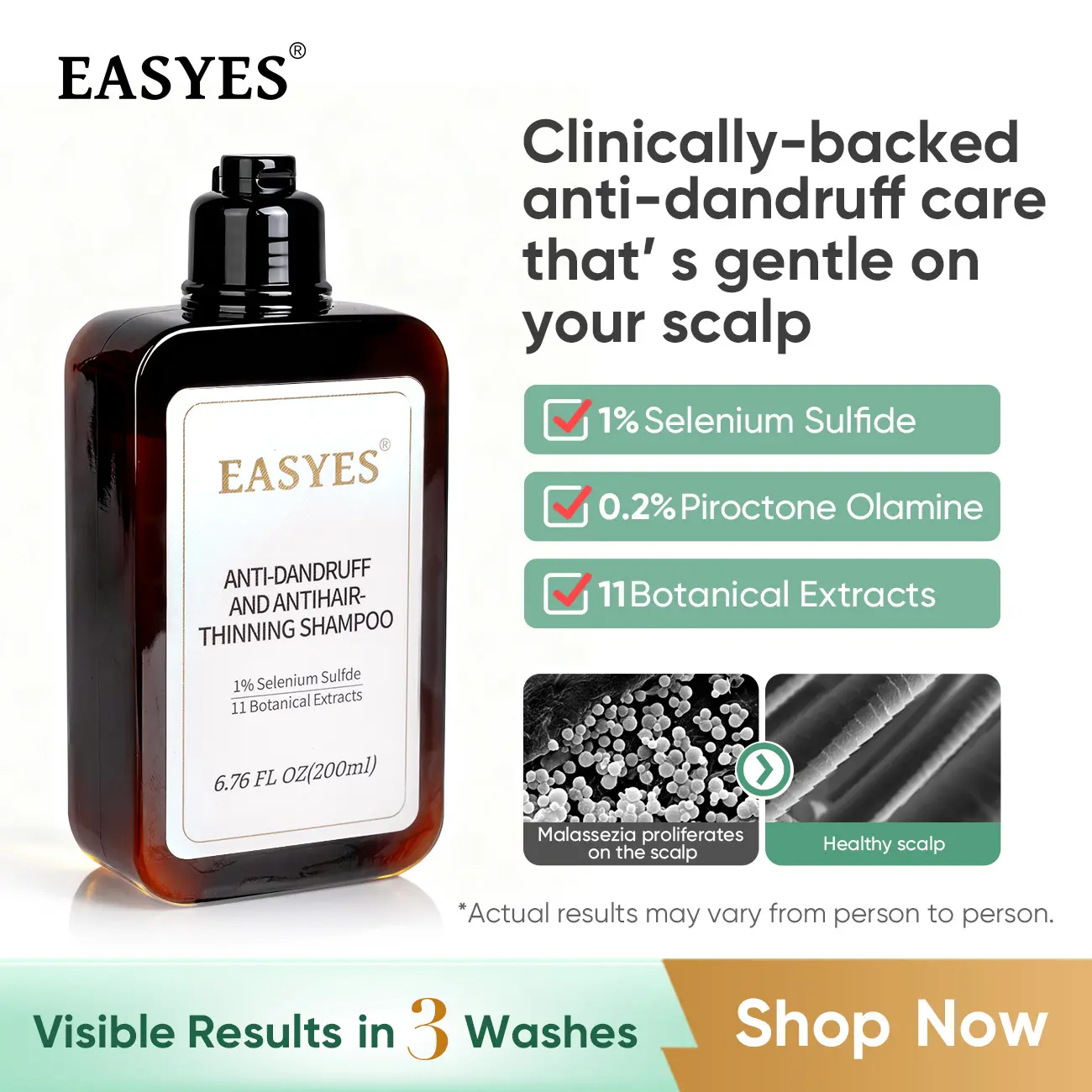 Easyes Anti-Dandruff & Anti-Thinning Shampoo, 3-in-1 Liquid Scalp Cleanser with 1% Selenium Sulfide & Rosemary, Vegan Haircare for All Hair Types, Woody Scent for Men & Women, 6.76 fl oz, Any, Color & Chemically Treated, Centella, Adults, Ceramides, Scent