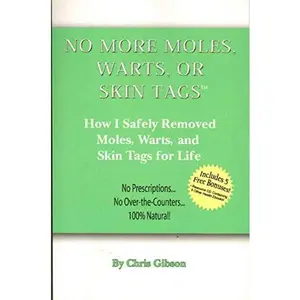 USED-NO MORE MOLES WARTS OR SKIN TAGS! How I Safely Removed Moles, Warts, and Skin Tags for Life by Chris Gibson (Paperback)