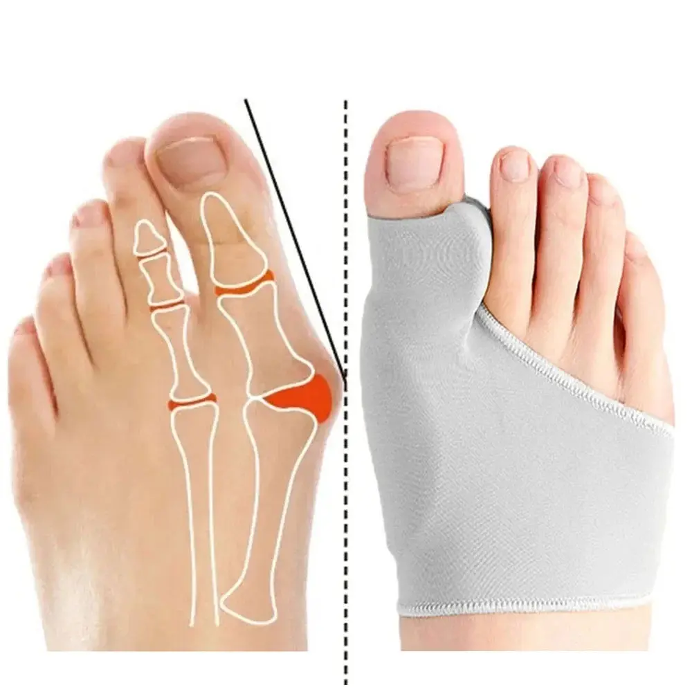 Foot Toe Separator, Bunion Correction Orthopedic Shoe Insole, Adjustable Foot Support Pad, Flexible Fabric, Comfortable Fit Design, Ideal for Daily Wear, Relieves Big Toe Pain, Bunion Corrector, Foot Care Product