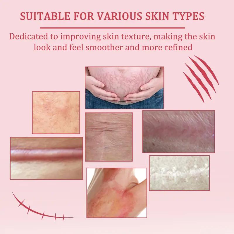 MAYLOR 2 Pack Silicone Scar Gel for Face & Body – Fast Scar Removal Cream for Acne, Surgical, Burn & Keloid Scars – Visible Results for Old & New Scars, Smooth Skin Repair