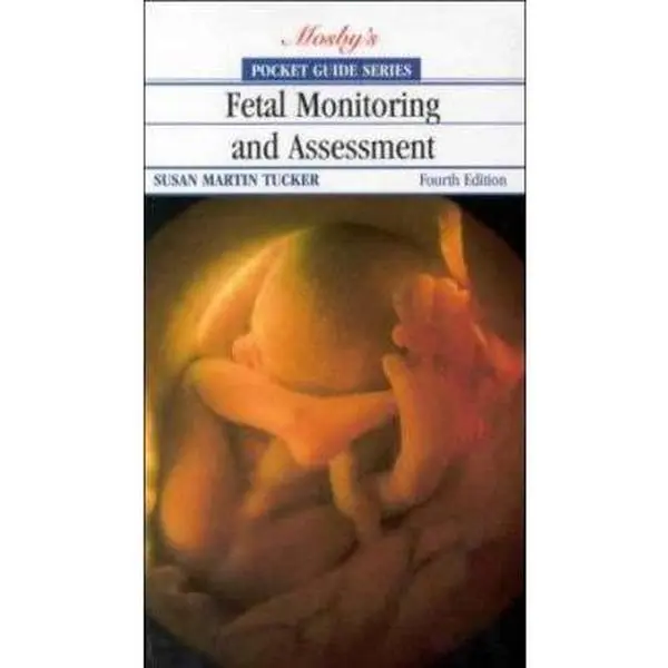 USED Mosby Pocket Guide to Fetal Monitoring and Assessment - Lisa A. Miller CNM JD, Fetal Heart Rate, Clinical, Patient-Focused, Very Good Condition (English Paperback), 358 Pages