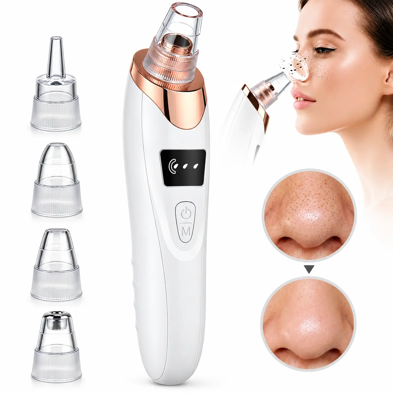 Blackhead Pore Vacuum Cleaner, USB Rechargeable Blackhead Extractor, 3 Speed Suction And 5 Tips Blackhead Suction Facial Blackhead And Pore Deep Cleanser Facial Skin Care Tool