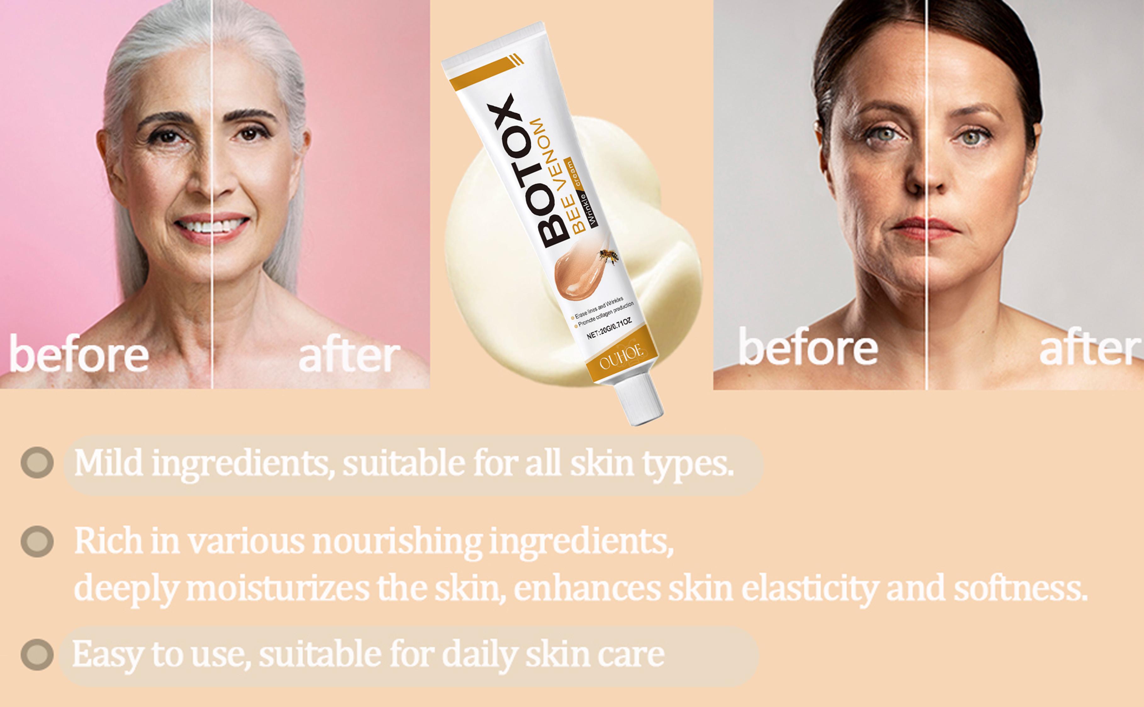 Bee Venom Moisturiser Cream Wrinkle Removal & Firming, Anti-Aging Eye&Face Bee Venom Skin Treatment Cream, Natural And Non-Irritating, Lifting & Recovery For All Skin Type