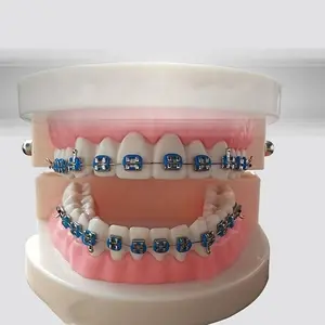 A pair of fashion metal tooth bracket decorations; a temporary colorful tooth decoration kit with hook for upper and lower teeth; fashionable tooth veneers made of metal; suitable for tooth models and as teaching materials in oral medicine/dentistry.