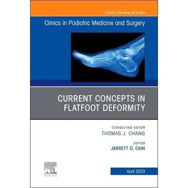 USED-Current Concepts in Flatfoot Deformity, an Issue of Clinics in Podiatric Medicine and Surgery: Volume 40-2 (Hardcover)