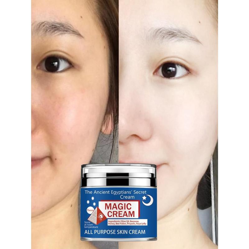 TRSTAY face cream is suitable for various skin types. face cream can moisturize skin, tighten skin, and make skin look brighter