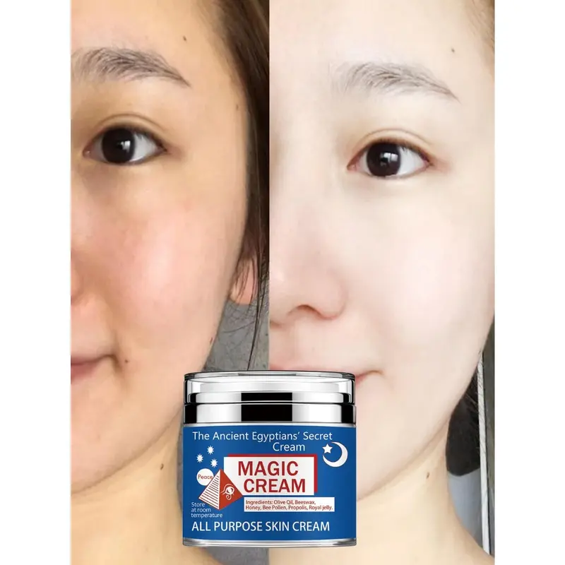 TRSTAY face cream is suitable for various skin types. face cream can moisturize skin, tighten skin, and make skin look brighter