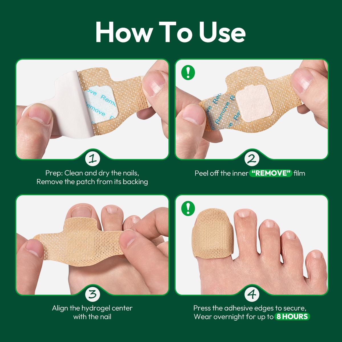 32PCS Fungal Nail Patches – Overnight Nail Repair Patches for Damaged & Discolored Nails, Hydrogel Nail Care Treatment