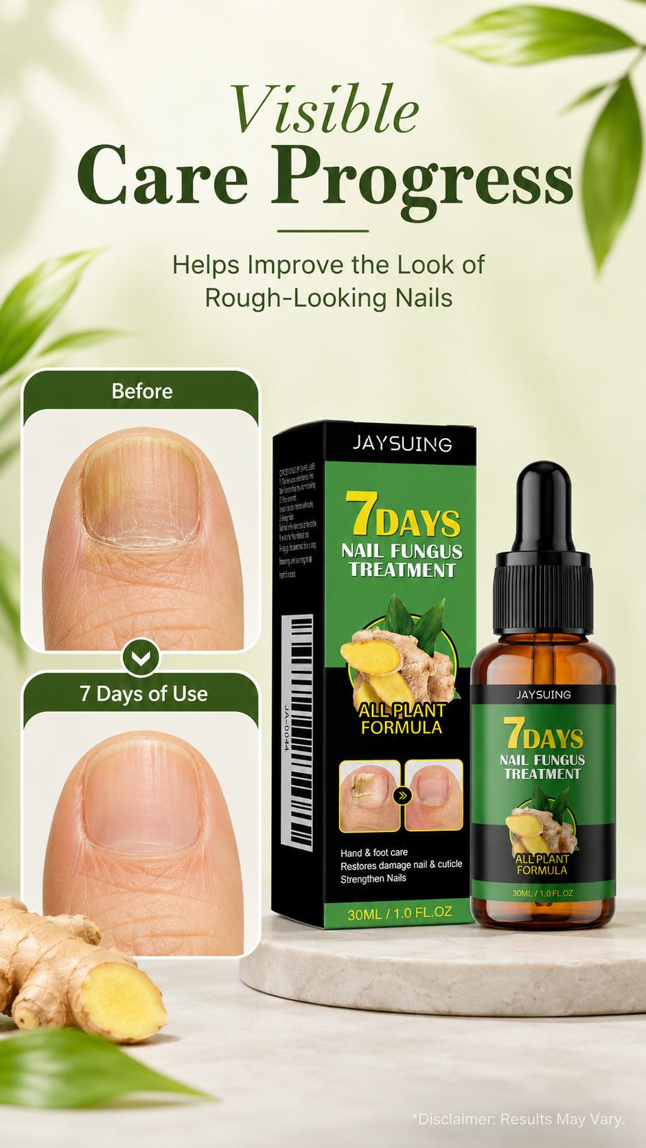 JAYSUING 7 Days Fast Acting Nail Care Essence, Cuticle Oil & Nail Growth Oil, 30 mL Ginger Root Dropper Serum for Rough‑Looking & Thick‑Looking Nails and Cuticles, Daily Hand and Foot Care