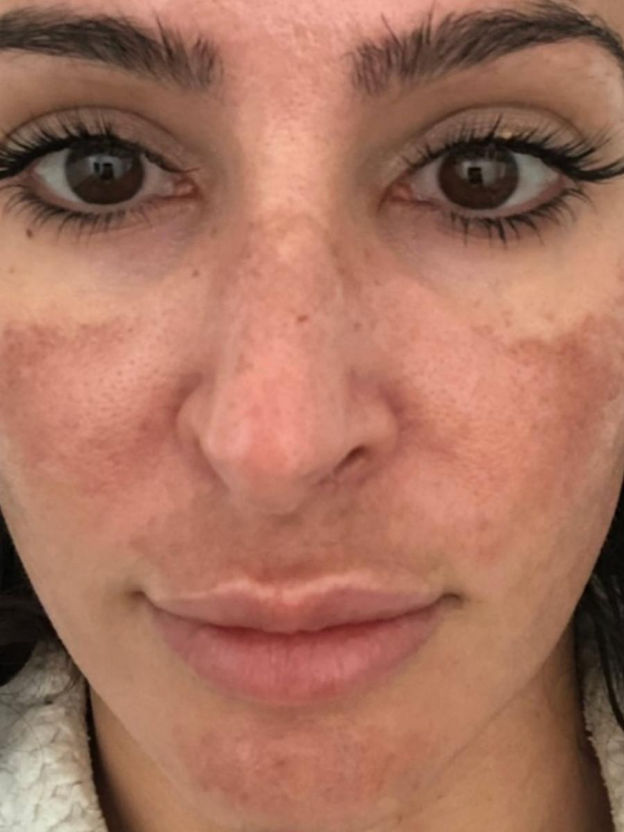 Item: 【6 Vials】50% off /15-day supply /Skin Firming