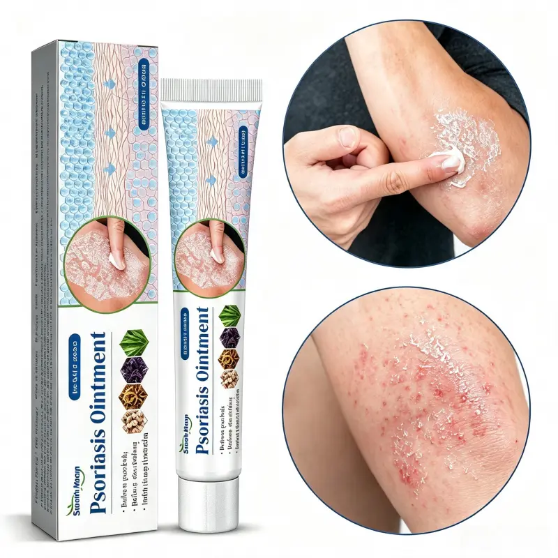 South Moon Herbal Psoriasis Ointment - Gentle Non-Greasy Moisturizing Balm for Fast Itchy Dry Flaky Rough Skin Relief, Target Spot Care for Elbows Knees Hands Ankles, Daily External Use for Seasonal Sensitive Skin