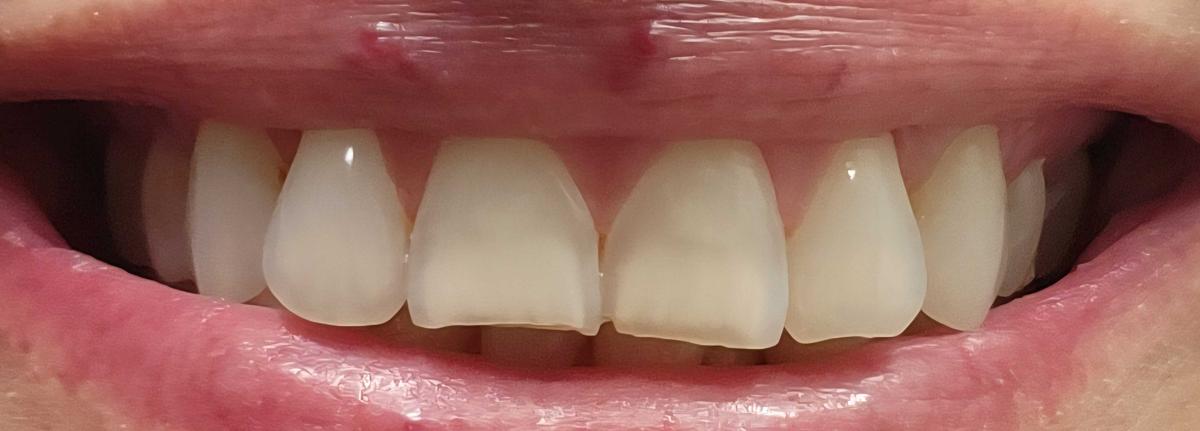 Item: 1 pc (Trial Packing)