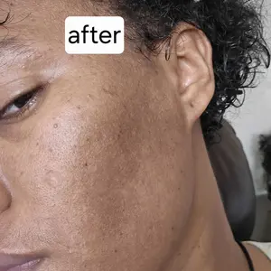 Product Review of [Dr.Melaxin Official] Peel Shot Glow Rice Ampoule Duo - Serums for Brightening, Exfoliating, and Moisturizing - Suitable for All Skin Types from e**e