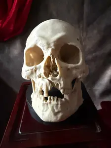 Battle Damaged Human Skull