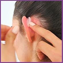 Cosmetic Protruding Ear Corrector for Ear Pinning without Surgery