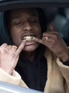 Standard and versatile gold braces set, Teeth hip-hop accessory, street style, unisex, trendy and cutting-edge, enhancing your temperament, Tooth Gems