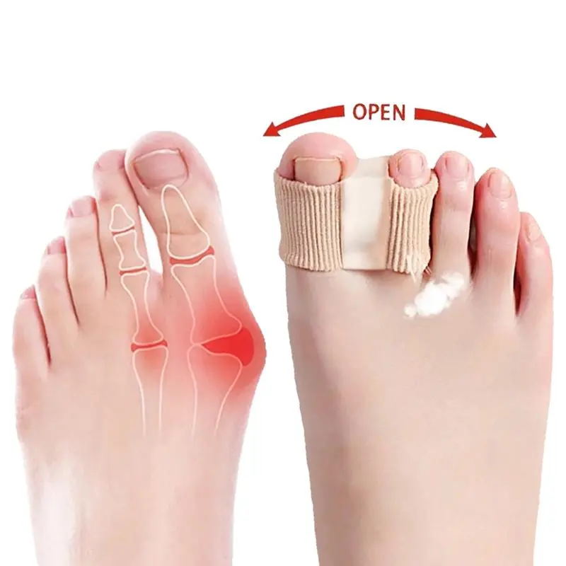 Double Hole Toe Corrector, Bunion Sleeve for Hallux Valgus, Overlapping Toe Separator