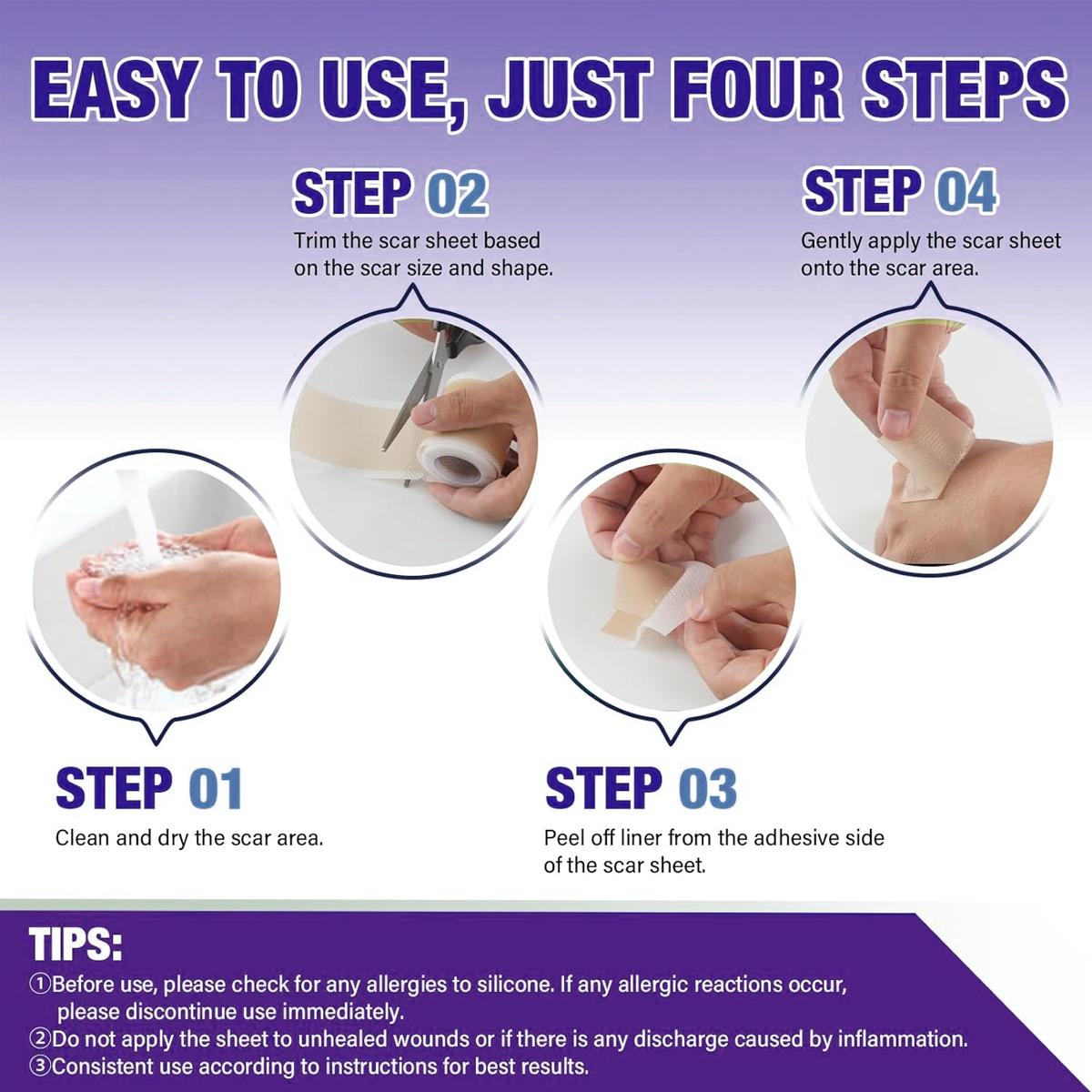 Silicone Scar Tape,Silicone Scar Sheet Silicone Removal Strips(1.6"X 59" Roll-1.5M) For Surgical Scars, Reusagble Effective Removal Silicone Scar Removal Strips For Surgical,Tummy Tuck C- Section