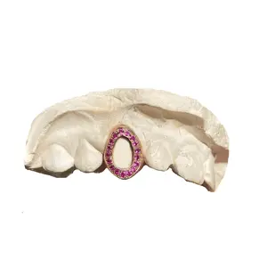 Magenta Sapphire Open Face Grillz (14K, Rose Gold)
