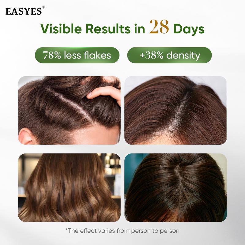 【BQ】EASYES Anti-Dandruff & Hair Thickening Shampoo | 1% Selenium Sulfide + 0.2% Piroctone Olamine | 11 Herbal Actives for 78% Less Flakes & +38% Density in 7 Days | #ScalpCare #HairGrowth