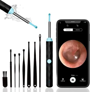 Ear Wax Removal, Earwax Remover Tool with 8 Pcs Ear Set & 6 Ear Spoon- Ear Cleaner with Camera & Light, Ear Camera for iOS & Android (Black) Springtok