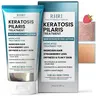 Keratosis Pilaris Treatment | Keratosis Pilaris Lotion with 10% AHA | Gentle Exfoliation For Strawberry Legs, KP & Ingrown Hairs | Smooth & Hydrating Body Lotion For Redness, Dry, Rough And Flaky Skin